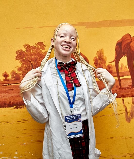 Hope for people with albinism as young innovator develops organic sunscreen